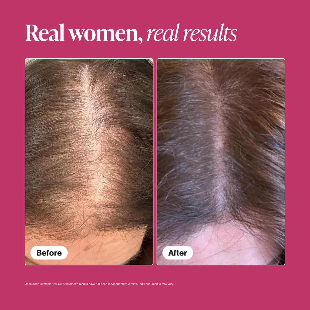 Hair Growth Supplements for Women, 60 Tablets C60797